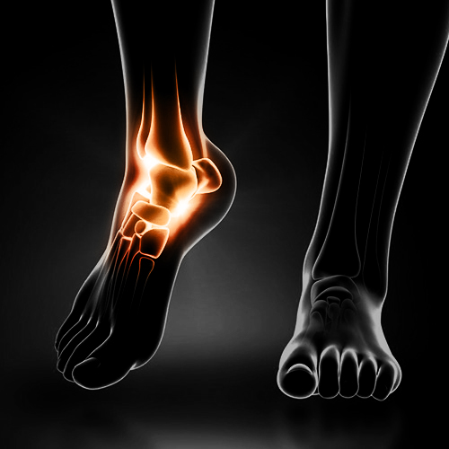 ankle pain