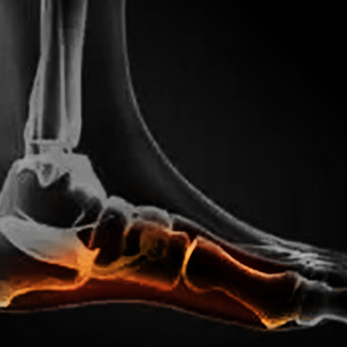 foot and toe pain