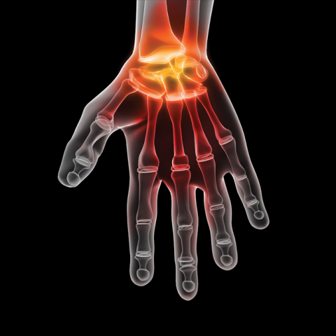 hand pain