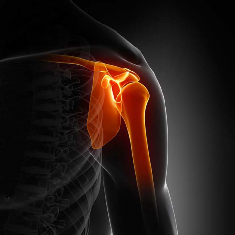 shoulder pain