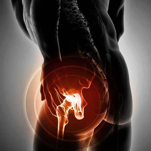 hip pain
