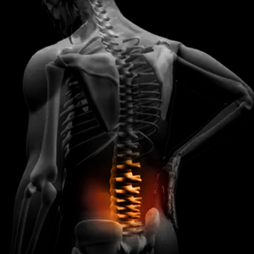lower back pain