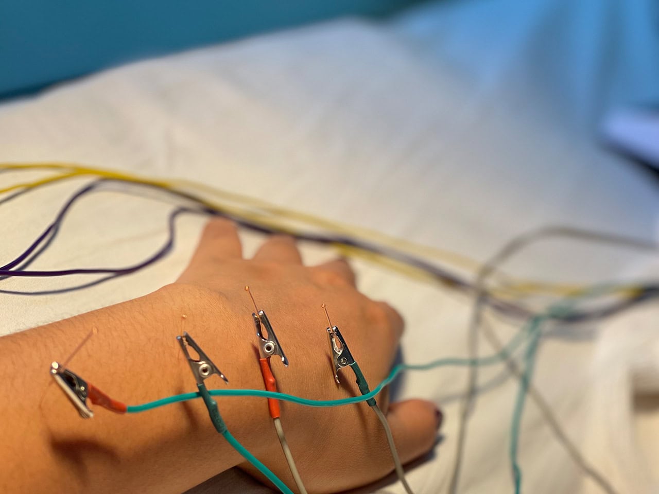 performing ncv tests on a hand