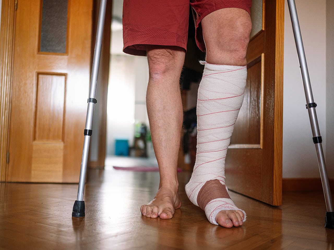 man with crutches and a leg injury